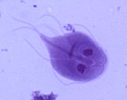 Giardia giza gorputzetik